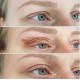 PLASMA PEN FIBROBLAST PROFESIONAL PARA REJUVENECIEMIENTO FACIAL O CORPORAL