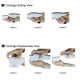 Liposonix + Hifu facial y corporal - (rejuvenecimiento y adelgazamiento)