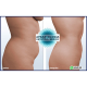 Electroestimulador Gimnasia Pasiva