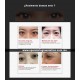LASER OFTÁLMICO ANTINFLAMATORIO - TÉRMICO PARA ELIMINAR OJERAS Y BOLSAS EN LOS OJOS (inalámbrico)