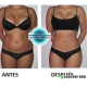 Cavitacion 2.0+ Radiofrecuencia Sextupolar(cuerpo)/ Cuadrupolar(rostro/cuerpo) /Tripolar(rostro) + Vacum c/RF Bipolar +LIPOLASER