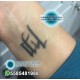 Picosecond Picolaser YAG portátil para eliminación de manchas o tatuajes